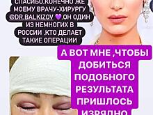 Дана Борисова показала честное фото своего лица через неделю после нашумевшей операции «лисьи глазки»