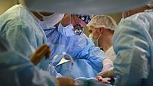 Хирурги впервые провели операцию по извлечению тромба из мозговой артерии