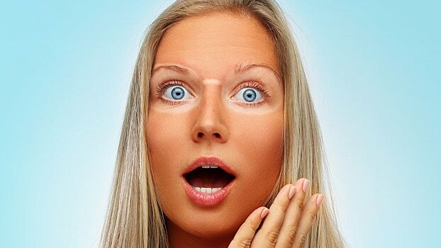 Что делать, если я сгорел на солнце?