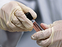 В США спортсмены начнут сдавать допинг-тесты дистанционно