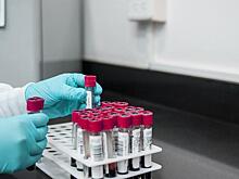 РУСАДА: С 2021 г. WADA сможет без предварительного уведомления получать пробы антидопинговых лабораторий
