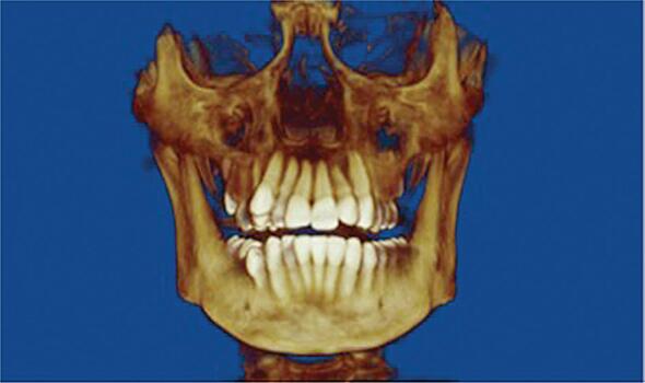 В МГМУ протестировали эффективный подход к диагностике трещин в зубах