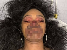 Девушка с реалистичным гримом зомби ввела в заблуждение врачей