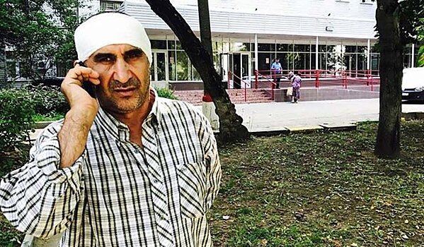 Дворнику таджику заплатили 150 тысяч рублей за откушенное ухо