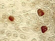 Генетическое исследование хламидий заставит пересмотреть диагностику заболеваний