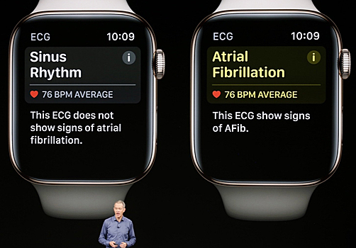 «Умные» часы Apple спасли женщину во время сна