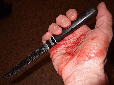 Нижегородка ударила себя ножом, чтобы остановить избивавшего ее мужа