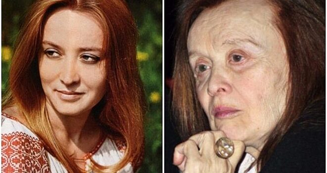 Терехова маргарита до и после пластики