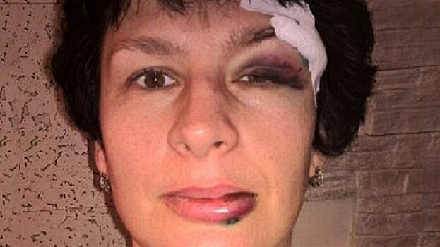 «Наложили 15 швов» — тюменка разбила лицо на горке в аквапарке