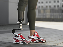 Даже не извинился: семья 15-летней девушки, которая потеряла ногу в ДТП, опасается безнаказанности виновника