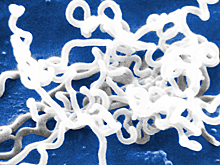 Выяснилось, какая опасная инфекция старше цивилизации