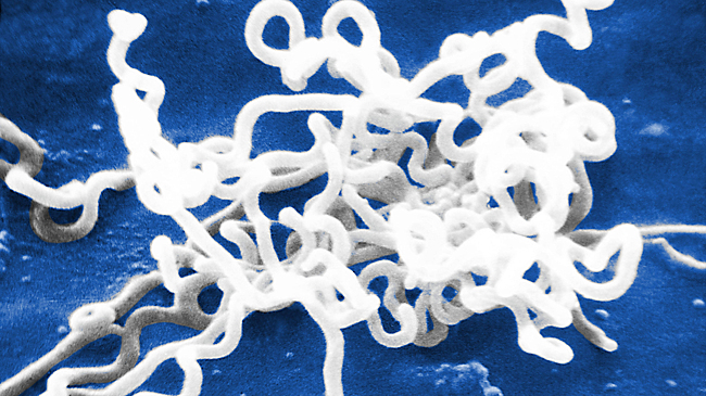 Выяснилось, какая опасная инфекция старше цивилизации