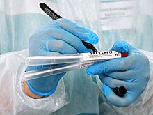 В Севастополе выявили четыре новых случая заражения коронавирусом