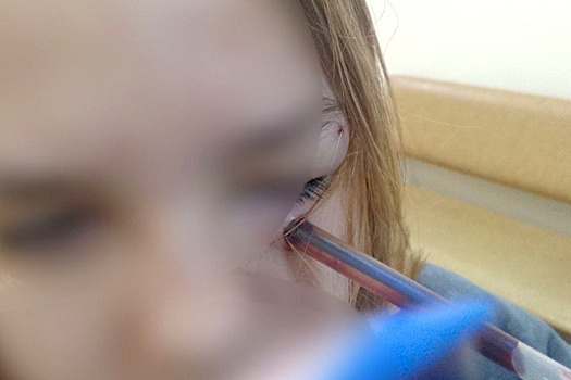 В Приморье школьник воткнул ручку в глаз однокласснице