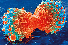 Назван главный прорыв в лечении рака