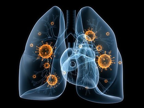 Признаки, которые помогают распознать наличие скрытой пневмонии (без высокой температуры и кашля)