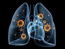 Признаки, которые помогают распознать наличие скрытой пневмонии (без высокой температуры и кашля)
