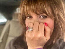 Алиса Аршавина рассказала о состоянии после выписки: "Нос и скулы все больше деформируются"
