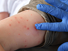 Вирусологи предупредили о надвигающейся эпидемии