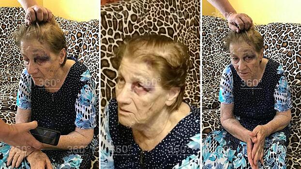 Краснодарскую пенсионерку жестоко избили в психиатрической больнице