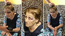 Краснодарскую пенсионерку жестоко избили в психиатрической больнице