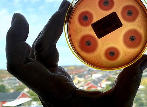 Из-за изменений климата в США начали распространяться смертельные плотоядные бактерии: Новости ➕1, 23.03.2023