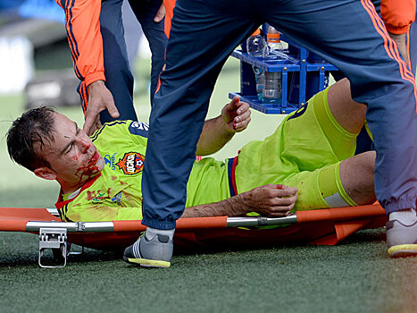 Получившего травму головы футболиста ЦСКА оставили в больнице