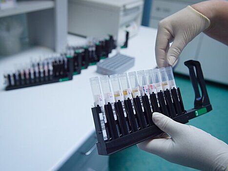 В РФ не выявлено опасных для человека вариантов вируса птичьего гриппа – Попова