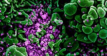 Nature (Великобритания): миниатюрные органы показывают, как коронавирус поражает организм