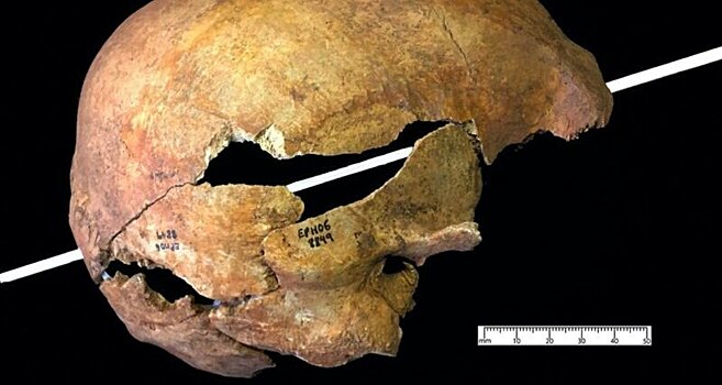 Стрелы английского лука могли ранить, как пули