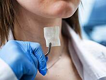 В России создали первый 3D-имплант гортани для онкобольных