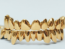 8 главных трендов стоматологов: от аудио-наркоза до арт-пломб