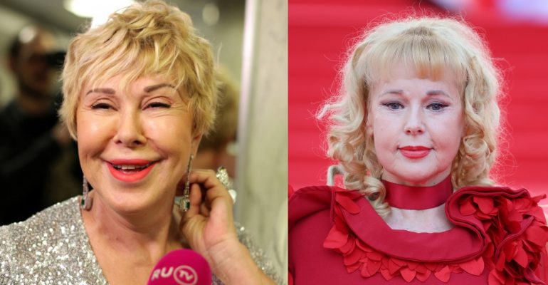 Анастасия Вертинская Фото Пластика