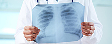 Пульмонолог Лукьянов: Печное отопление и угольная пыль в воздухе могут вызвать заболевания лёгких