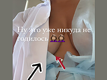 Певица Слава показала грудь до подтяжки и пожаловалась на постоперационные боли