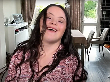 18-летняя модель с синдромом Дауна стала звездой кампании Gucci на страницах Vogue (ФОТО)