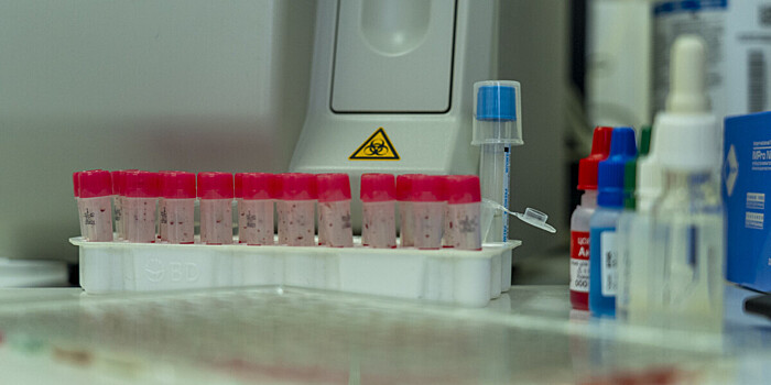 Первый случай заболевания новым штаммом оспы обезьян выявлен в Великобритании