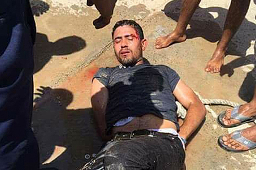 Раненный в Хургаде армянин помог обезвредить нападавшего