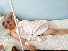 Ветерана СВО без ноги жестоко избили в Забайкалье