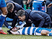 Футболисту наступили на лицо во время матча