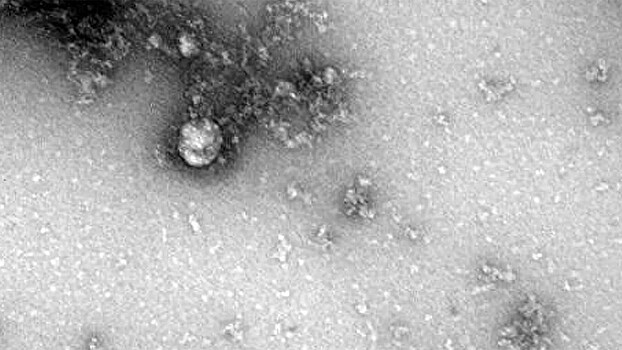 В десяти странах обнаружили новый штамм коронавируса