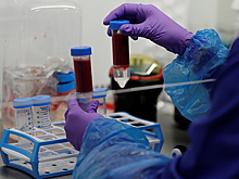 Названы повышающие риск заражения COVID группы крови