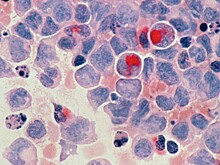 Разработан способ ускорить создание новых лекарств от рака