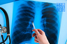 В Дагестане будут использовать высокие технологии для лечения больных туберкулезом