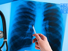 В Дагестане будут использовать высокие технологии для лечения больных туберкулезом