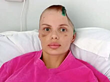 Избитая модель из Краснодарского края отказалсь от мирового соглашения с обидчиком