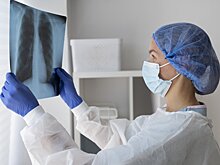 Около 50 новых рентгенаппаратов установили в Подмосковье с начала 2022 года