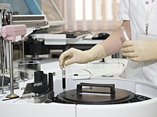 Врач Малиновская рассказала о самых важных анализах, которые рекомендуется сдавать ежегодно