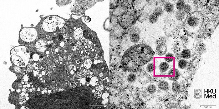Ученые впервые сфотографировали «омикрон»-штамм коронавируса