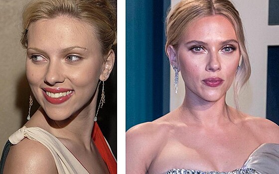 Звезды, которые сделали пластику до 30 лет